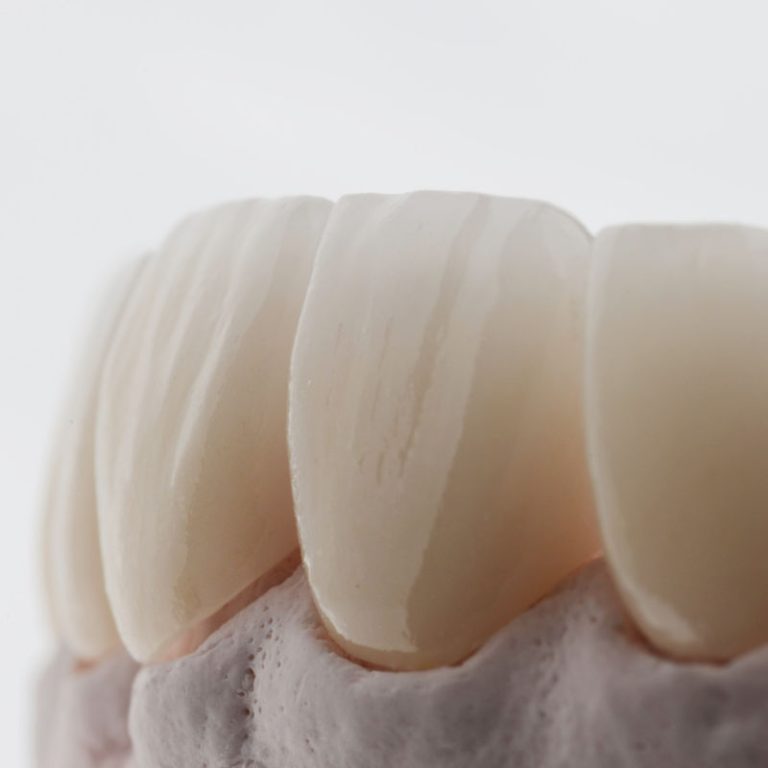 tratamientos estéticos dentales