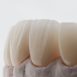 tratamientos estéticos dentales