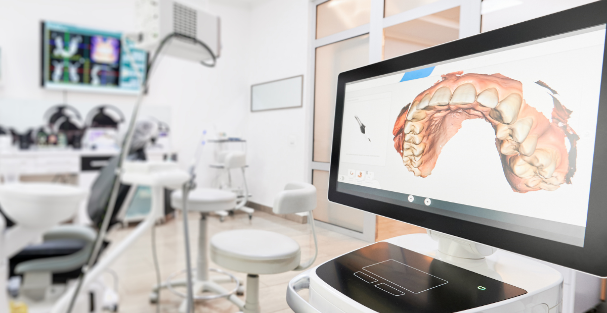 Innovación en implantología: Scanbodies y tecnología CAD-CAM Innovación en implantología: Scanbodies y tecnología CAD-CAM
