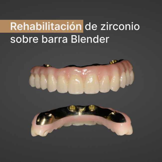 imagen nota-1