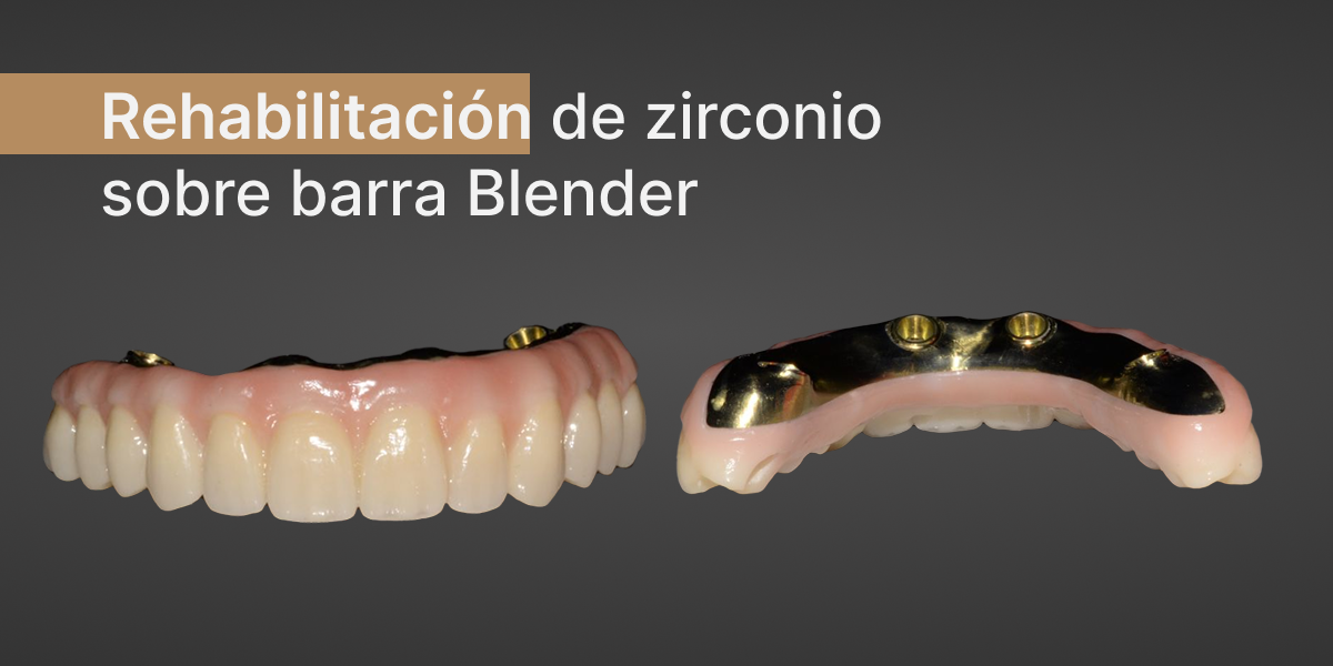 rehabilitacion-zirconio-barra-blender